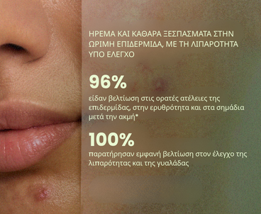 Biome-Balancing Calm & Recover Cream- Κρέμα για Ακμή